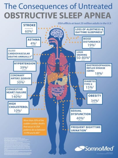 Sleep Apnea